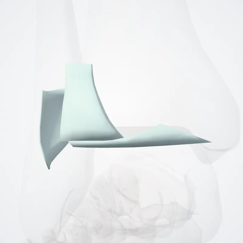 Tibiofibular syndesmosis (Syndesmosis tibiofibularis) highlighted in a 3D model of the human body