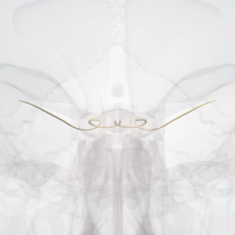 Nervus trochlearis (IV) (Trochlear nerve (IV)) hervorgehoben in einem 3D-Modell des menschlichen Körpers
