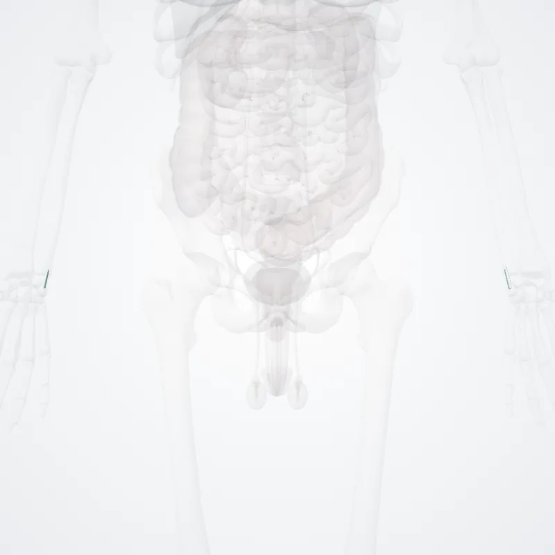 Ligamentum ulnopisiforme (Ulnopisiform ligament) hervorgehoben in einem 3D-Modell des menschlichen Körpers