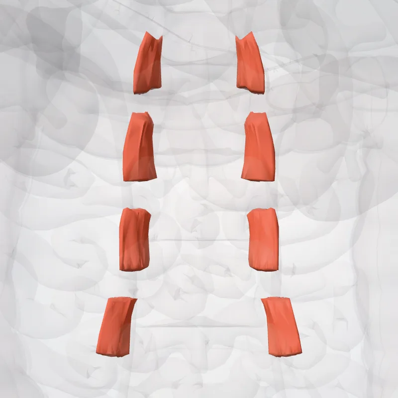 Partes vent. musculorum intertransversariorum lat. lumborum (Ventral parts of lateral intertransversarii lumborum muscles) hervorgehoben in einem 3D-Modell des menschlichen Körpers
